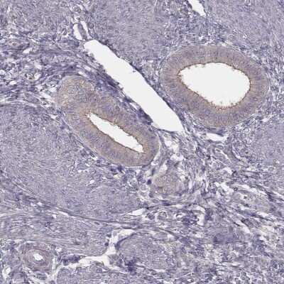 Immunohistochemistry-Paraffin: TDRD5 Antibody [NBP1-81971]