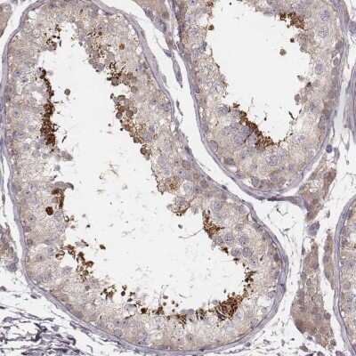 Immunohistochemistry-Paraffin: TDRD5 Antibody [NBP1-81971]