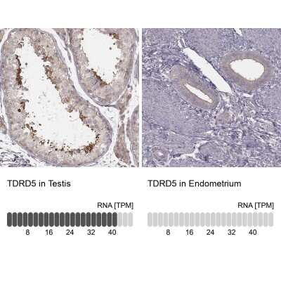 Immunohistochemistry-Paraffin: TDRD5 Antibody [NBP1-81971]
