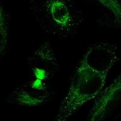 Immunocytochemistry/ Immunofluorescence: TDRD6 Antibody [NBP3-16968]