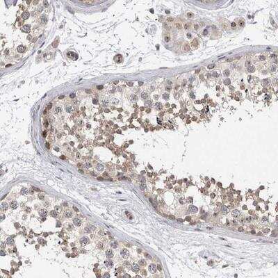 Immunohistochemistry: TDRD7 Antibody [NBP1-87315]