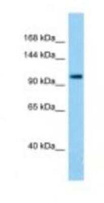 Western Blot: TDRD7 Antibody [NBP1-98585]