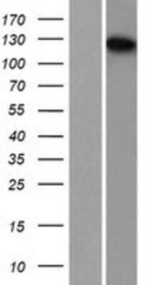 Western Blot: TDRD7 Overexpression Lysate [NBP2-07357]