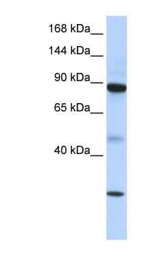 Western Blot: TDRD9 Antibody [NBP1-57116]