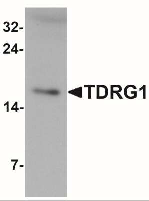 Western Blot: TDRG1 AntibodyBSA Free [NBP2-41197]