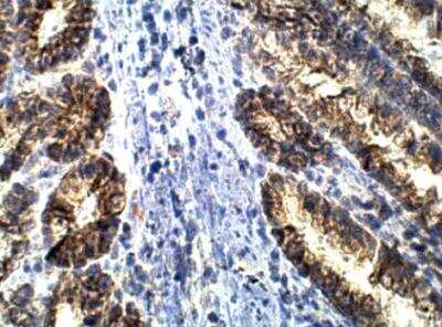 Immunohistochemistry-Paraffin: TDRKH Antibody [NBP3-12498]