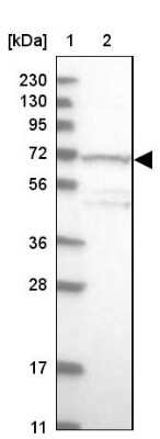 Western Blot: TDRKH Antibody [NBP1-80697]