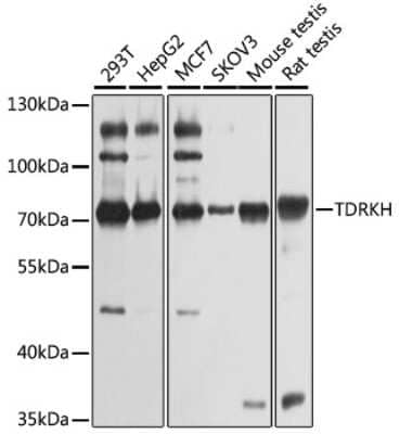 Western Blot: TDRKH AntibodyBSA Free [NBP2-95203]