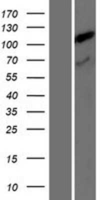 Western Blot: TDRKH Overexpression Lysate [NBP2-07569]