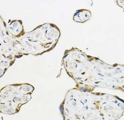 Immunohistochemistry-Paraffin: TEAD3 Antibody - BSA Free [NBP2-93128]