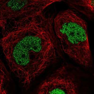 Immunocytochemistry/ Immunofluorescence: TEAD4 Antibody [NBP2-33803]