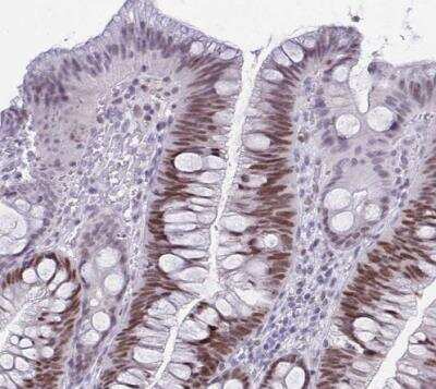 Immunohistochemistry-Paraffin: TEAD4 Antibody [NBP2-33803]