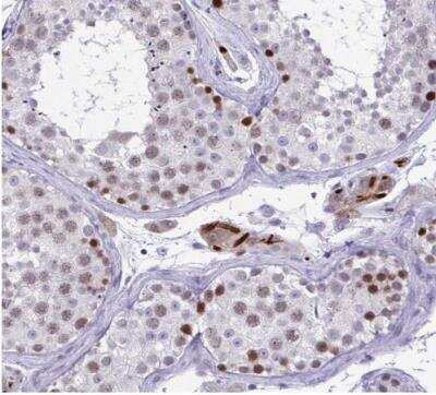 Immunohistochemistry-Paraffin: TEAD4 Antibody [NBP2-33803]