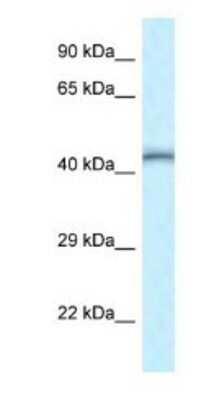 Western Blot: TEAD4 Antibody [NBP1-82386]