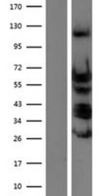 Western Blot: TEAD4 Overexpression Lysate [NBP2-08028]