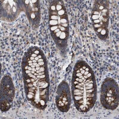 Immunohistochemistry-Paraffin: TECPR1 Antibody [NBP1-84206]