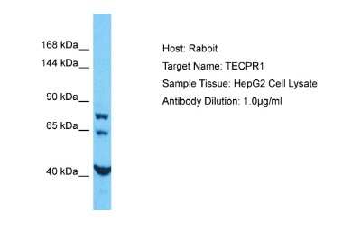 Western Blot: TECPR1 Antibody [NBP2-83637]