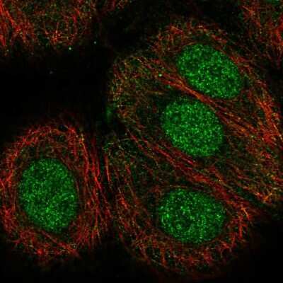 Immunocytochemistry/ Immunofluorescence: TECPR2 Antibody [NBP1-93642]