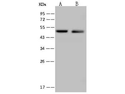 Western Blot: TEDC1 Antibody [NBP2-98663]