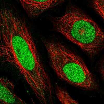 Immunocytochemistry/ Immunofluorescence: TEF1 Antibody [NBP2-56300]