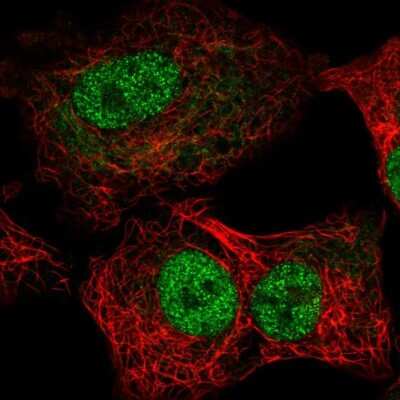 Immunocytochemistry/ Immunofluorescence: TEF1 Antibody [NBP2-56713]