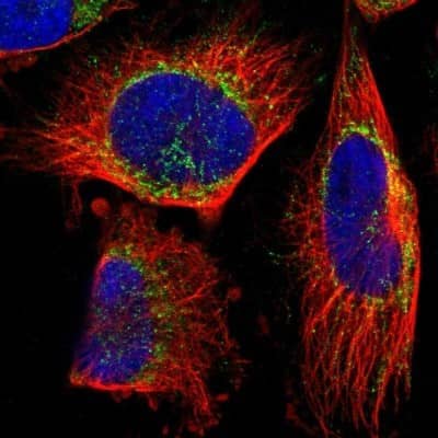 Immunocytochemistry/ Immunofluorescence: TEFM Antibody [NBP1-82109]