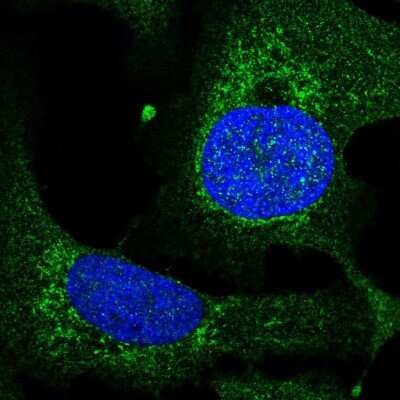 Immunocytochemistry/ Immunofluorescence: TEFM Antibody [NBP2-55665]