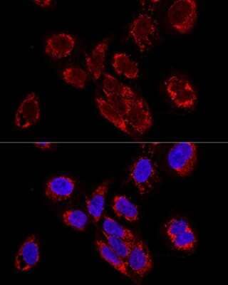 Immunocytochemistry/ Immunofluorescence: TEFM Antibody - BSA Free [NBP2-94080]