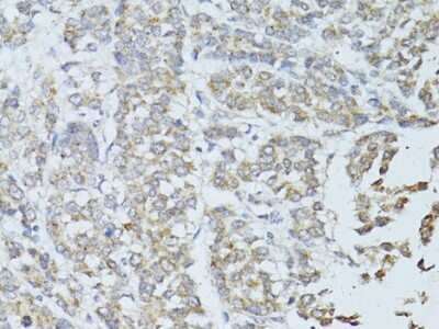 Immunohistochemistry-Paraffin: TEFM Antibody - BSA Free [NBP2-94080]