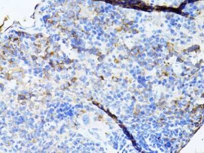 Immunohistochemistry-Paraffin: TEFM Antibody - BSA Free [NBP2-94080]