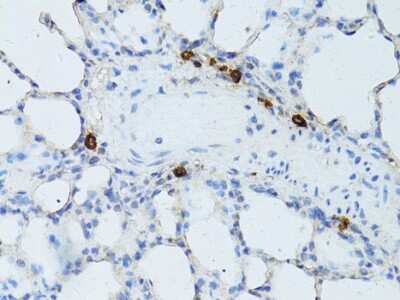 Immunohistochemistry-Paraffin: TEFM Antibody - BSA Free [NBP2-94080]