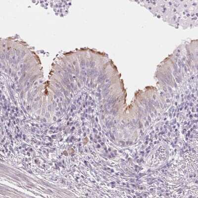 Immunohistochemistry: TEKT1 Antibody [NBP2-49363]