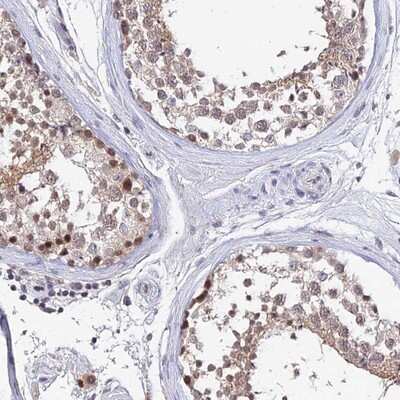 Immunohistochemistry-Paraffin: TEKT1 Antibody [NBP1-92487]