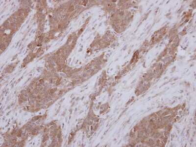 Immunohistochemistry-Paraffin: TEKT1 Antibody [NBP2-20593]