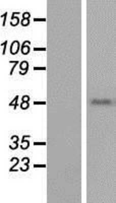 Western Blot: TEKT1 Overexpression Lysate [NBP2-05814]