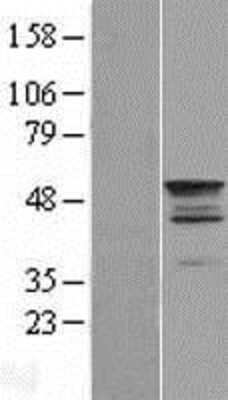 Western Blot: TEKT2 Overexpression Lysate [NBL1-16810]