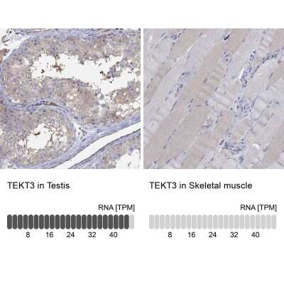 Immunocytochemistry/ Immunofluorescence: TEKT3 Antibody [NBP3-17094]