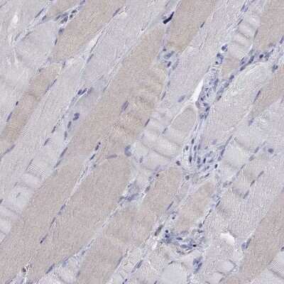 Immunohistochemistry-Paraffin: TEKT3 Antibody [NBP3-17094]