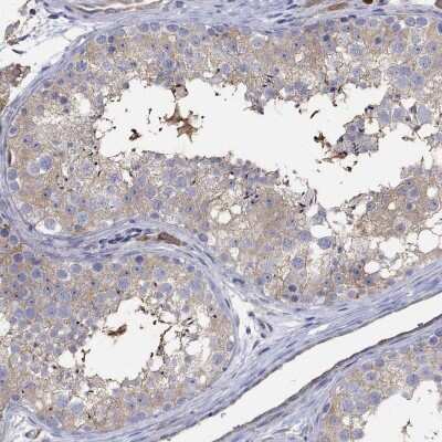 Immunohistochemistry-Paraffin: TEKT3 Antibody [NBP3-17094]