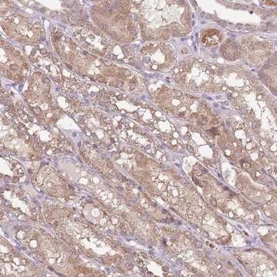 Immunohistochemistry-Paraffin: TEKT4 Antibody [NBP2-13425]