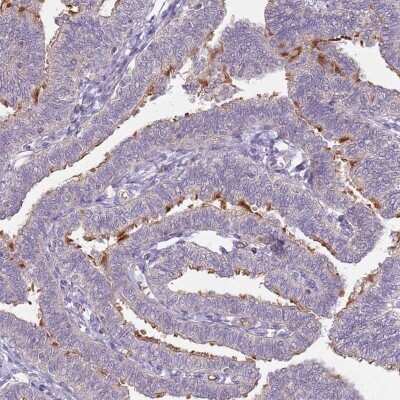 Immunohistochemistry-Paraffin: TEKT4 Antibody [NBP2-13425]