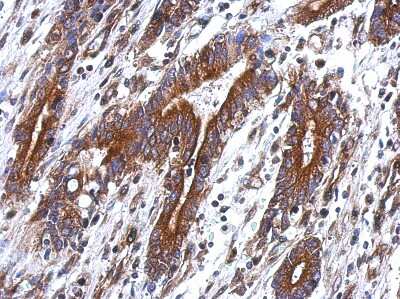 Immunohistochemistry-Paraffin: TEKT4 Antibody [NBP2-20594]