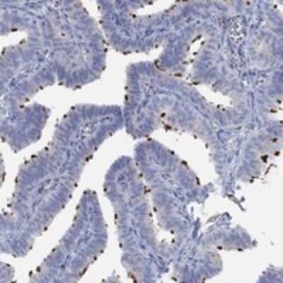 Immunohistochemistry-Paraffin: TEKT4 Antibody [NBP3-17946]