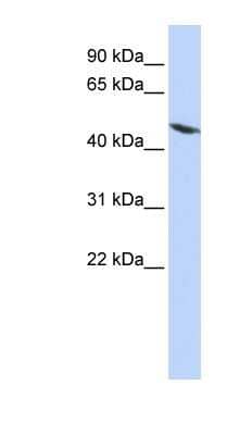 Western Blot: TEKT4 Antibody [NBP1-56636]