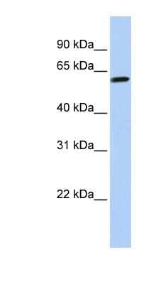 Western Blot: TEKT4 Antibody [NBP1-57589]