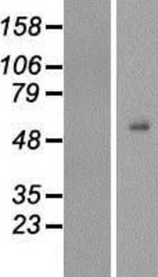 Western Blot: TEKT4 Overexpression Lysate [NBP2-05532]