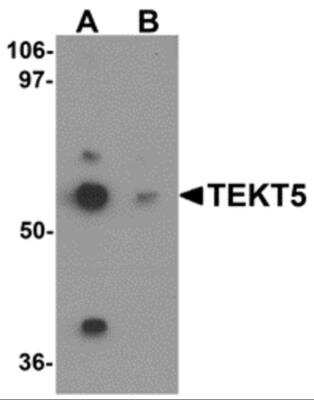 Western Blot: TEKT5 AntibodyBSA Free [NBP2-81832]