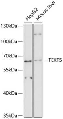 Western Blot: TEKT5 AntibodyAzide and BSA Free [NBP2-94009]