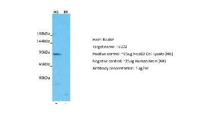 Western Blot: TEL2 Antibody [NBP2-85900]