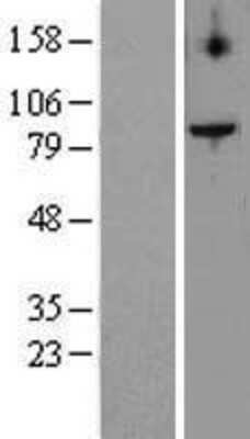 Western Blot: TEL2 Overexpression Lysate [NBL1-16813]